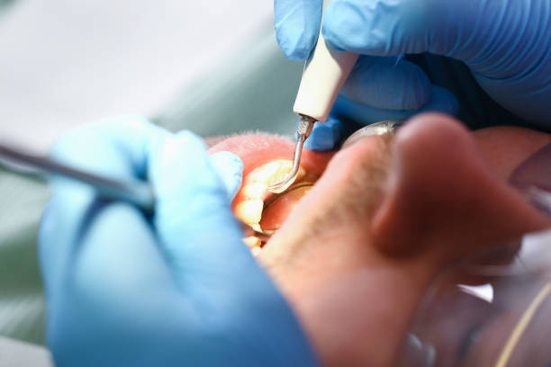 Best Emergency Denture Repair in Ama, LA