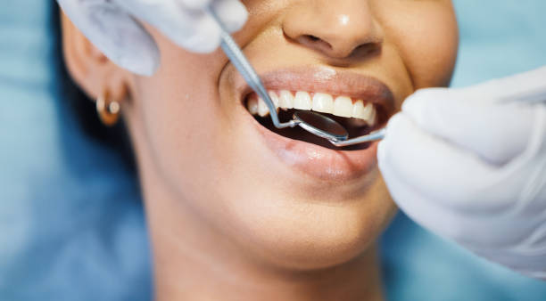 Best Emergency Treatment for Oral Infections in Ama, LA
